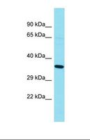 GKAP1 Antibody - Western blot of Human Fetal Kidney. GKAP1 antibody dilution 1.0 ug/ml.  This image was taken for the unconjugated form of this product. Other forms have not been tested.
