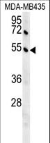 GKAP1 Antibody - GKAP1 Antibody western blot of MDA-MB435 cell line lysates (35 ug/lane). The GKAP1 antibody detected the GKAP1 protein (arrow).