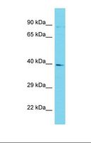 GKAP1 Antibody - Western blot of Human HCT15. GKAP1 antibody dilution 1.0 ug/ml.  This image was taken for the unconjugated form of this product. Other forms have not been tested.
