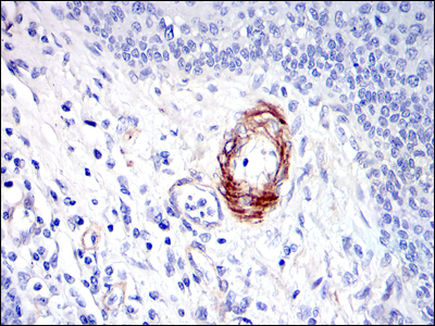 GKAP1 Antibody - IHC of paraffin-embedded human esophagus tissues using GKAP mouse monoclonal antibody with DAB staining.