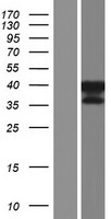 GKAP1 Protein - Western validation with an anti-DDK antibody * L: Control HEK293 lysate R: Over-expression lysate