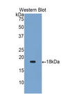 GKN1 / Gastrokine 1 Antibody - Western blot of recombinant GKN1 / Gastrokine 1.  This image was taken for the unconjugated form of this product. Other forms have not been tested.