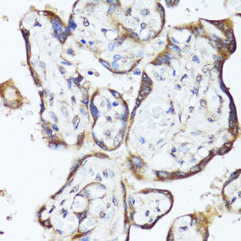 GKN1 / Gastrokine 1 Antibody - Immunohistochemistry of paraffin-embedded human placenta using GKN1 antibody at dilution of 1:150 (40x lens).
