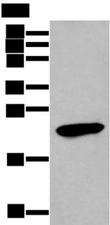 GKN1 / Gastrokine 1 Antibody - Western blot analysis of Human stomach tissue lysate  using GKN1 Polyclonal Antibody at dilution of 1:250