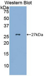 GKN2 / Gastrokine 2 Antibody - Western blot of recombinant GKN2 / Gastrokine 2.  This image was taken for the unconjugated form of this product. Other forms have not been tested.