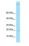 GKN2 / Gastrokine 2 Antibody - GKN2 antibody Western Blot of Fetal Liver.  This image was taken for the unconjugated form of this product. Other forms have not been tested.