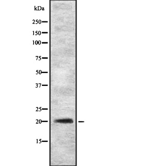 GKN2 / Gastrokine 2 Antibody - Western blot analysis of GKN2 expression in HEK293 cells. The lane on the left is treated with the antigen-specific peptide.