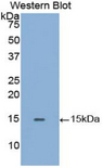 GLA / Alpha Galactosidase Antibody - Western blot of recombinant GLA / Alpha Galactosidase.  This image was taken for the unconjugated form of this product. Other forms have not been tested.