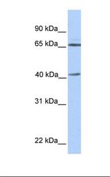 GLA / Alpha Galactosidase Antibody - Fetal brain lysate. Antibody concentration: 1.0 ug/ml. Gel concentration: 12%.  This image was taken for the unconjugated form of this product. Other forms have not been tested.