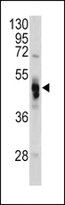 GLA / Alpha Galactosidase Antibody - Western blot of GLA antibody in HeLa cell line lysates (35 ug/lane). GLA (arrow) was detected using the purified antibody.