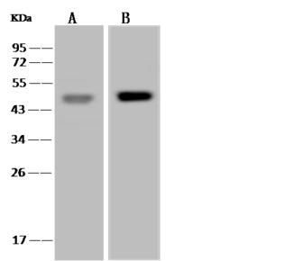 GLA / Alpha Galactosidase Antibody - Anti-GLA mouse monoclonal antibody at 1:500 dilution. Lane A: 293T Whole Cell Lysate. Lane B: MCF7 Whole Cell Lysate. Lysates/proteins at 30 ug per lane. Secondary: Goat Anti-Mouse IgG (H+L)/HRP at 1/10000 dilution. Developed using the ECL technique. Performed under reducing conditions. Predicted band size: 49 kDa. Observed band size: 49 kDa.