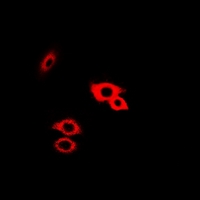 GLA / Alpha Galactosidase Antibody - Immunofluorescent analysis of Alpha-galactosidase A staining in HeLa cells. Formalin-fixed cells were permeabilized with 0.1% Triton X-100 in TBS for 5-10 minutes and blocked with 3% BSA-PBS for 30 minutes at room temperature. Cells were probed with the primary antibody in 3% BSA-PBS and incubated overnight at 4 deg C in a humidified chamber. Cells were washed with PBST and incubated with a DyLight 594-conjugated secondary antibody (red) in PBS at room temperature in the dark.
