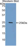 GLB1 / Beta-Galactosidase Antibody - Western blot of recombinant GLB1 / Beta-Galactosidase.  This image was taken for the unconjugated form of this product. Other forms have not been tested.