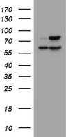 GLB1 / Beta-Galactosidase Antibody - HEK293T cells were transfected with the pCMV6-ENTRY control (Left lane) or pCMV6-ENTRY GLB1 (Right lane) cDNA for 48 hrs and lysed. Equivalent amounts of cell lysates (5 ug per lane) were separated by SDS-PAGE and immunoblotted with anti-GLB1.