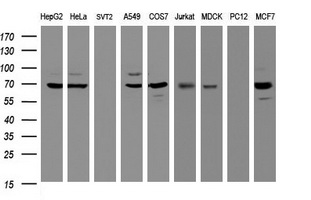 GLB1 / Beta-Galactosidase Antibody - Western blot of extracts (35 ug) from 9 different cell lines by using anti-GLB1 monoclonal antibody (HepG2: human; HeLa: human; SVT2: mouse; A549: human; COS7: monkey; Jurkat: human; MDCK: canine; PC12: rat; MCF7: human).