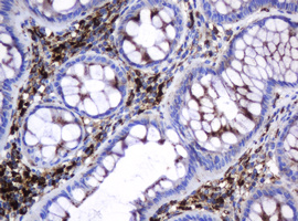 GLB1 / Beta-Galactosidase Antibody - IHC of paraffin-embedded Human colon tissue using anti-GLB1 mouse monoclonal antibody.