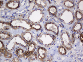 GLB1 / Beta-Galactosidase Antibody - IHC of paraffin-embedded Human Kidney tissue using anti-GLB1 mouse monoclonal antibody.