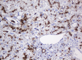 GLB1 / Beta-Galactosidase Antibody - IHC of paraffin-embedded Human liver tissue using anti-GLB1 mouse monoclonal antibody.