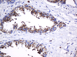 GLB1 / Beta-Galactosidase Antibody - IHC of paraffin-embedded Human prostate tissue using anti-GLB1 mouse monoclonal antibody.