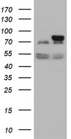 GLB1 / Beta-Galactosidase Antibody - HEK293T cells were transfected with the pCMV6-ENTRY control (Left lane) or pCMV6-ENTRY GLB1 (Right lane) cDNA for 48 hrs and lysed. Equivalent amounts of cell lysates (5 ug per lane) were separated by SDS-PAGE and immunoblotted with anti-GLB1.