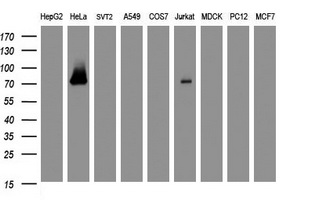 GLB1 / Beta-Galactosidase Antibody - Western blot of extracts (35 ug) from 9 different cell lines by using anti-GLB1 monoclonal antibody (HepG2: human; HeLa: human; SVT2: mouse; A549: human; COS7: monkey; Jurkat: human; MDCK: canine; PC12: rat; MCF7: human).