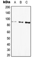 GLB1 / Beta-Galactosidase Antibody - Western blot analysis of Beta-galactosidase expression in HEK293T (A); HepG2 (B); PC12 (C) whole cell lysates.