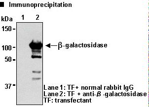 GLB1 / Beta-Galactosidase Antibody