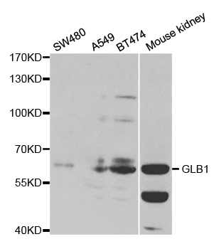 GLB1 / Beta-Galactosidase Antibody - Western blot analysis of extracts of various cell lines.