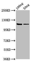GLB1 / Beta-Galactosidase Antibody - Western Blot Positive WB detected in: Recombinant protein All lanes: lacZ antibody at 7.5µg/ml Secondary Goat polyclonal to rabbit IgG at 1/50000 dilution Predicted band size: 117 kDa Observed band size: 117 kDa