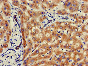 GLB1 / Beta-Galactosidase Antibody - Immunohistochemistry of paraffin-embedded human liver tissue at dilution of 1:100