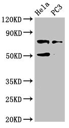 GLB1 / Beta-Galactosidase Antibody - Western Blot Positive WB detected in:Hela whole cell lysate,PC3 whole cell lysate All Lanes:GLB1 antibody at 4µg/ml Secondary Goat polyclonal to rabbit IgG at 1/50000 dilution Predicted band size: 77,61,73 KDa Observed band size: 77 KDa