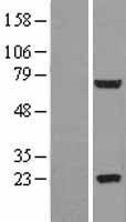 GLB1L2 Protein - Western validation with an anti-DDK antibody * L: Control HEK293 lysate R: Over-expression lysate