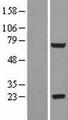 GLB1L2 Protein - Western validation with an anti-DDK antibody * L: Control HEK293 lysate R: Over-expression lysate