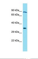 GLB1L3 Antibody - Western blot of Human 293T. GLB1L3 antibody dilution 1.0 ug/ml.  This image was taken for the unconjugated form of this product. Other forms have not been tested.