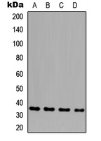 GLB1L3 Antibody - Western blot analysis of GLB1L3 expression in HeLa (A); THP1 (B); NS-1 (C); H9C2 (D) whole cell lysates.