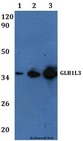 GLB1L3 Antibody - Western blot of GLB1L3 antibody at 1:500 Line1:HeLa whole cell lysate Line2:THP-1 whole cell lysate Line3:H9C2 whole cell lysate Line4:sp20 whole cell lysate.