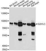 GLB1L3 Antibody - Western blot analysis of extracts of various cell lines, using GLB1L3 antibody at 1:1000 dilution. The secondary antibody used was an HRP Goat Anti-Rabbit IgG (H+L) at 1:10000 dilution. Lysates were loaded 25ug per lane and 3% nonfat dry milk in TBST was used for blocking. An ECL Kit was used for detection and the exposure time was 1s.