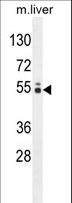 GLCCI1 Antibody - GLCCI1 Antibody western blot of mouse liver tissue lysates (35 ug/lane). The GLCCI1 antibody detected the GLCCI1 protein (arrow).