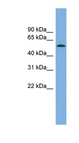 GLCCI1 Antibody - GLCCI1 antibody Western blot of Fetal Brain lysate. This image was taken for the unconjugated form of this product. Other forms have not been tested.