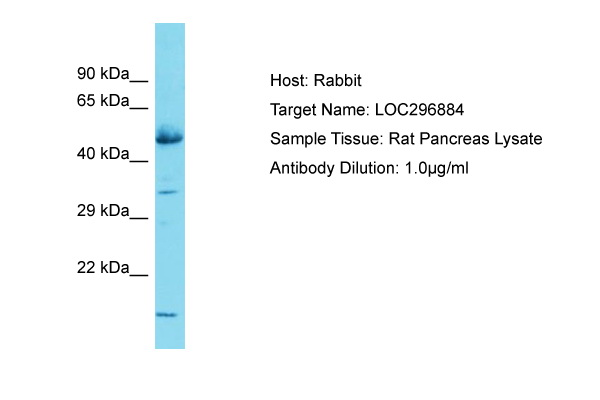 GLCCI1 Antibody -  This image was taken for the unconjugated form of this product. Other forms have not been tested.