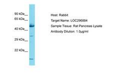 GLCCI1 Antibody -  This image was taken for the unconjugated form of this product. Other forms have not been tested.