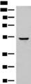 GLCCI1 Antibody - Western blot analysis of Human cerebella tissue lysate  using GLCCI1 Polyclonal Antibody at dilution of 1:400