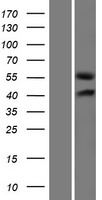 GLCCI1 Protein - Western validation with an anti-DDK antibody * L: Control HEK293 lysate R: Over-expression lysate