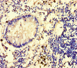 GLCE Antibody - Immunohistochemistry of paraffin-embedded human appendix tissue using GLCE Antibody at dilution of 1:100