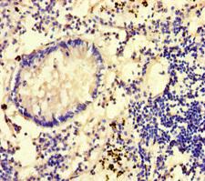 GLCE Antibody - Immunohistochemistry of paraffin-embedded human appendix tissue using GLCE Antibody at dilution of 1:100