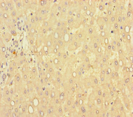 GLCE Antibody - Immunohistochemistry of paraffin-embedded human liver tissue using GLCE Antibody at dilution of 1:100