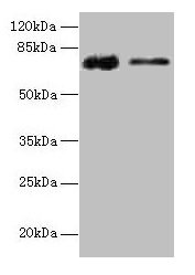 GLCE Antibody - Western blot All lanes: D-glucuronyl C5-epimerasel antibody at 12µg/ml Lane 1: Rat liver tissue Lane 2: Mouse kidney tissue Secondary Goat polyclonal to rabbit IgG at 1/10000 dilution Predicted band size: 70 kDa Observed band size: 70 kDa