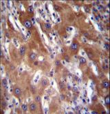 GLCNE / GNE Antibody - GNE Antibody immunohistochemistry of formalin-fixed and paraffin-embedded human liver tissue followed by peroxidase-conjugated secondary antibody and DAB staining.