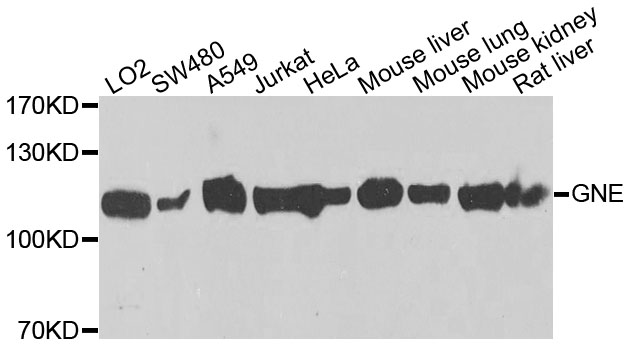 GLCNE / GNE Antibody - Western blot analysis of extracts of various cells.