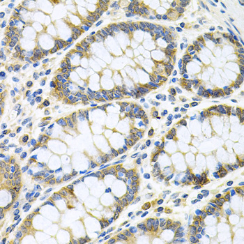 GLCNE / GNE Antibody - Immunohistochemistry of paraffin-embedded human colon tissue.